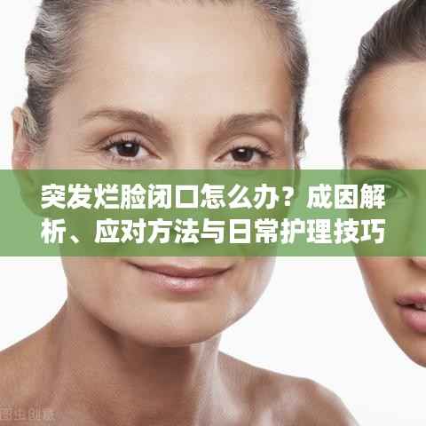 突发烂脸闭口怎么办？成因解析、应对方法与日常护理技巧