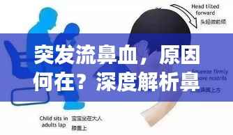 突发流鼻血,原因何在?深度解析鼻血背后的健康隐患