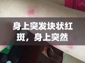 身上突发块状红斑,身上突然出现大块红斑,很痒是怎么回事,是过敏么