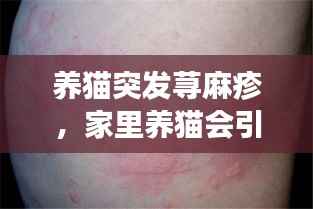 养猫突发荨麻疹,家里养猫会引起荨麻疹吗
