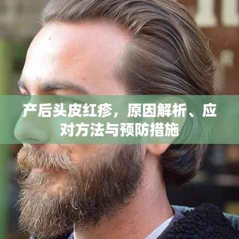 产后头皮红疹,原因解析、应对方法与预防措施