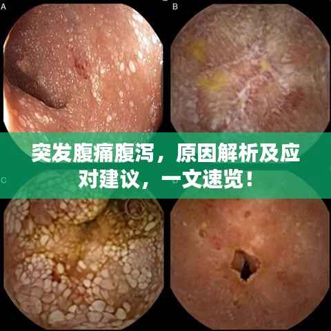 突发腹痛腹泻,原因解析及应对建议,一文速览!